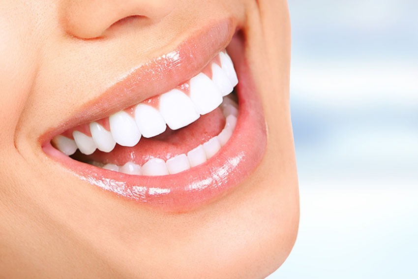 WHY TEENS PREFER CERAMIC BRACES HAWTHORN OVER METAL